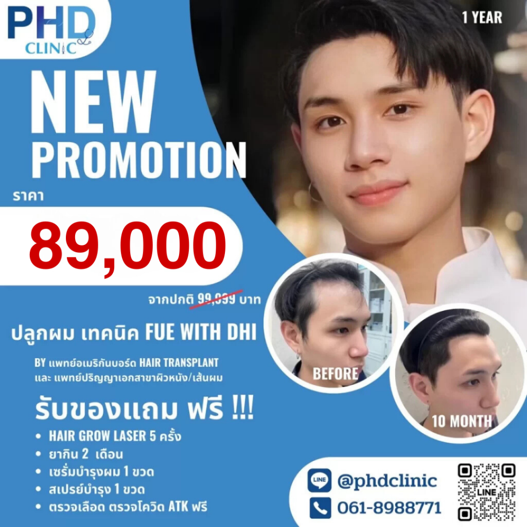 โปรปลูกผม