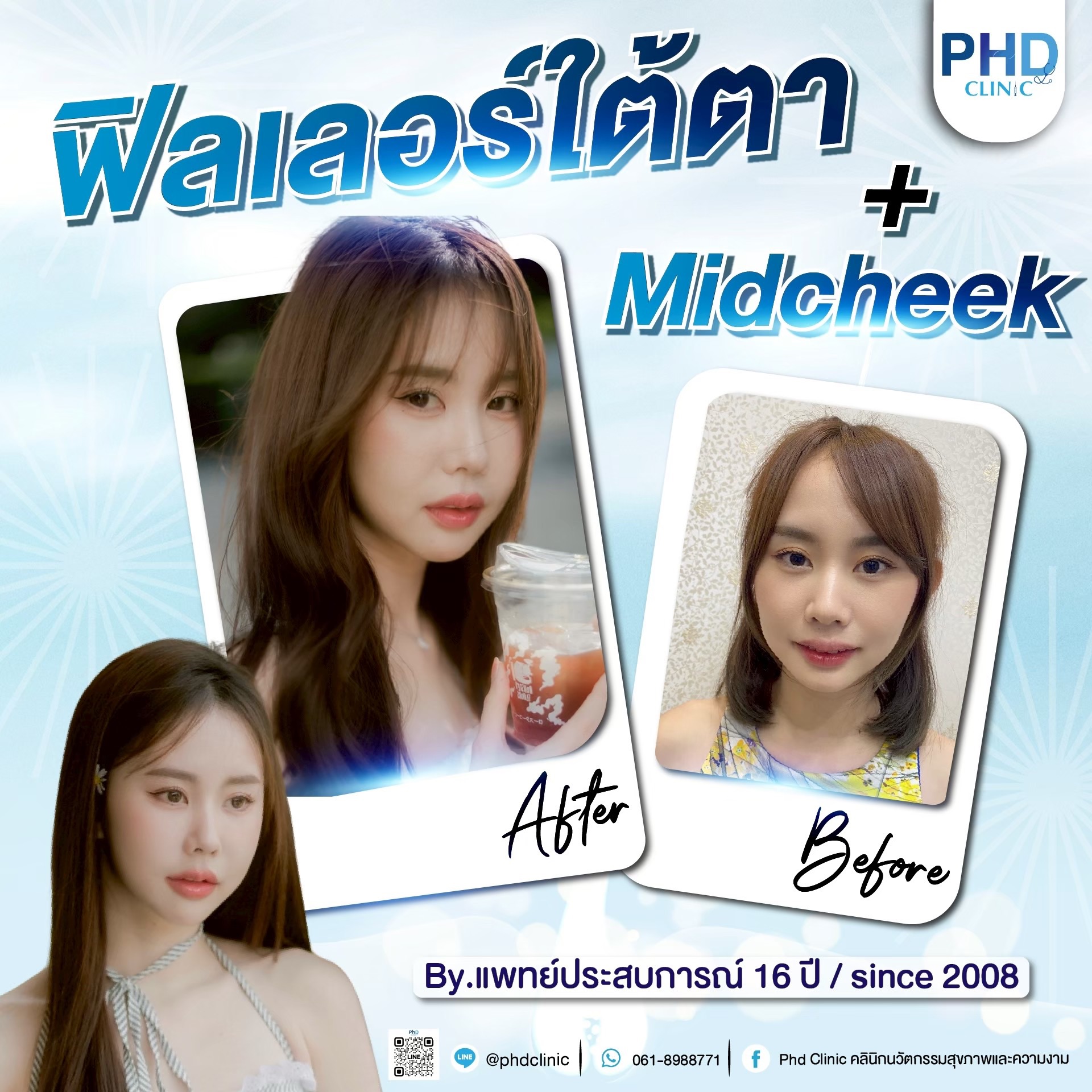 ปรับรูปหน้า