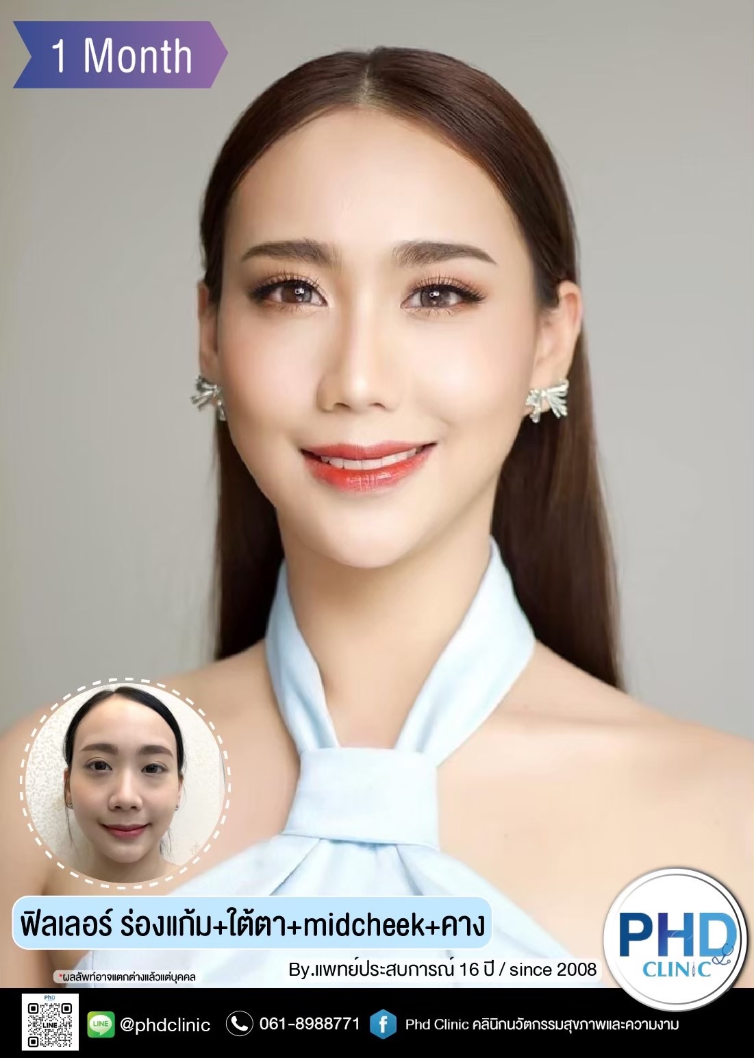 ปรับรูปหน้า