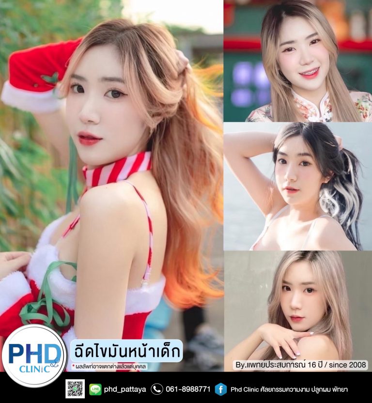 ฉีดไขมันหน้าพัทยา