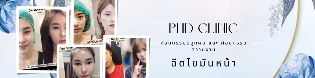 ฉีดไขมันหน้า