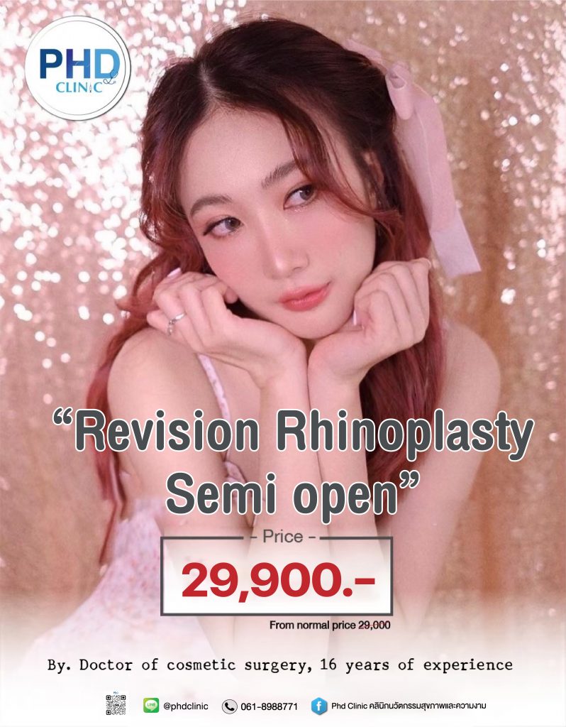 Revision Rhinoplasty