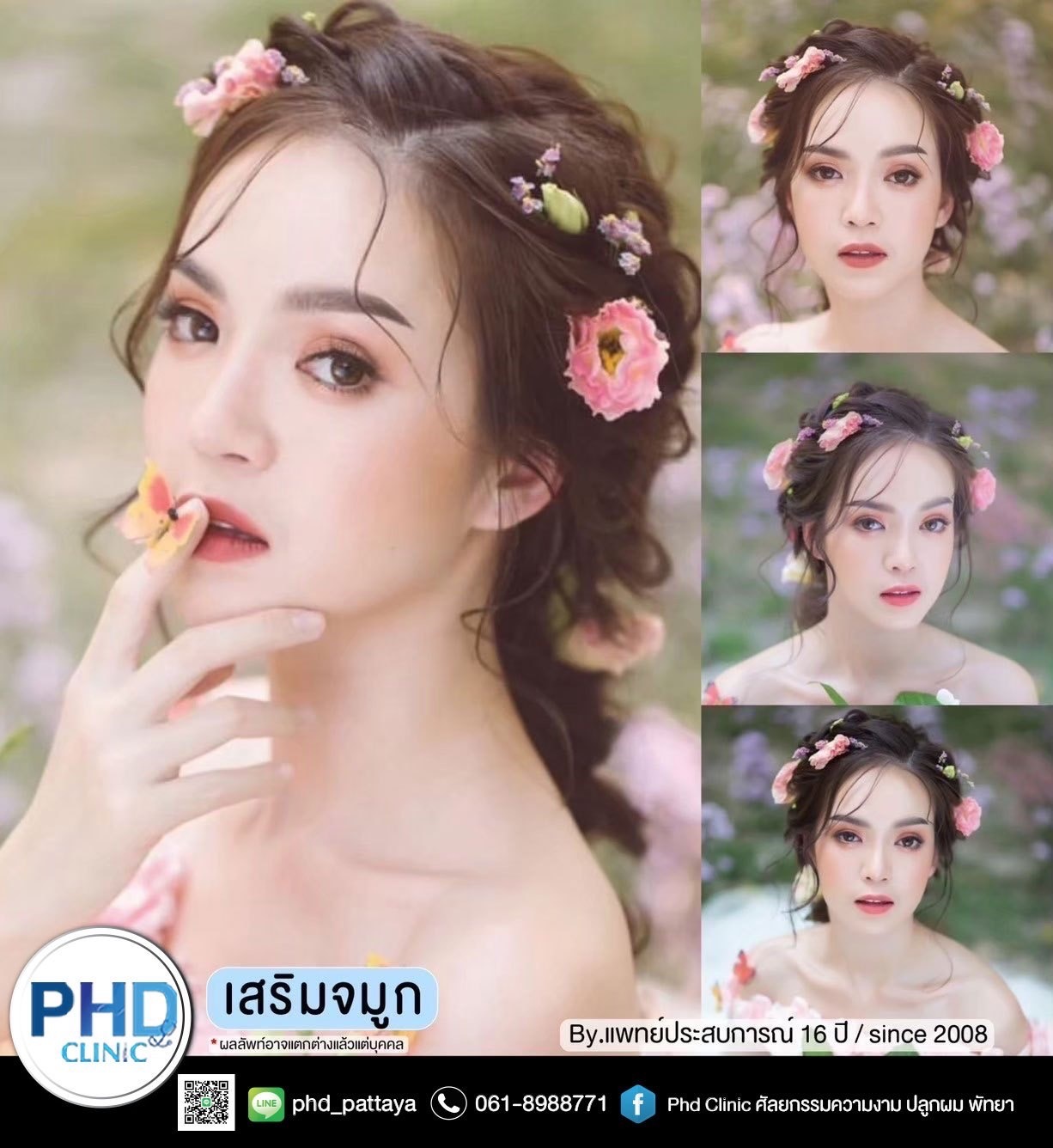 Revision Rhinoplasty Pattaya