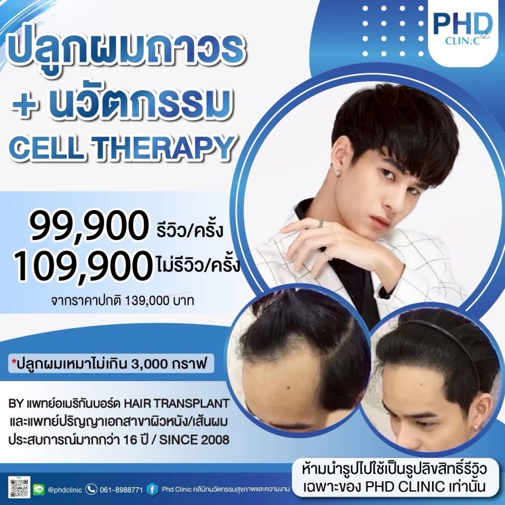 ปลูกผม