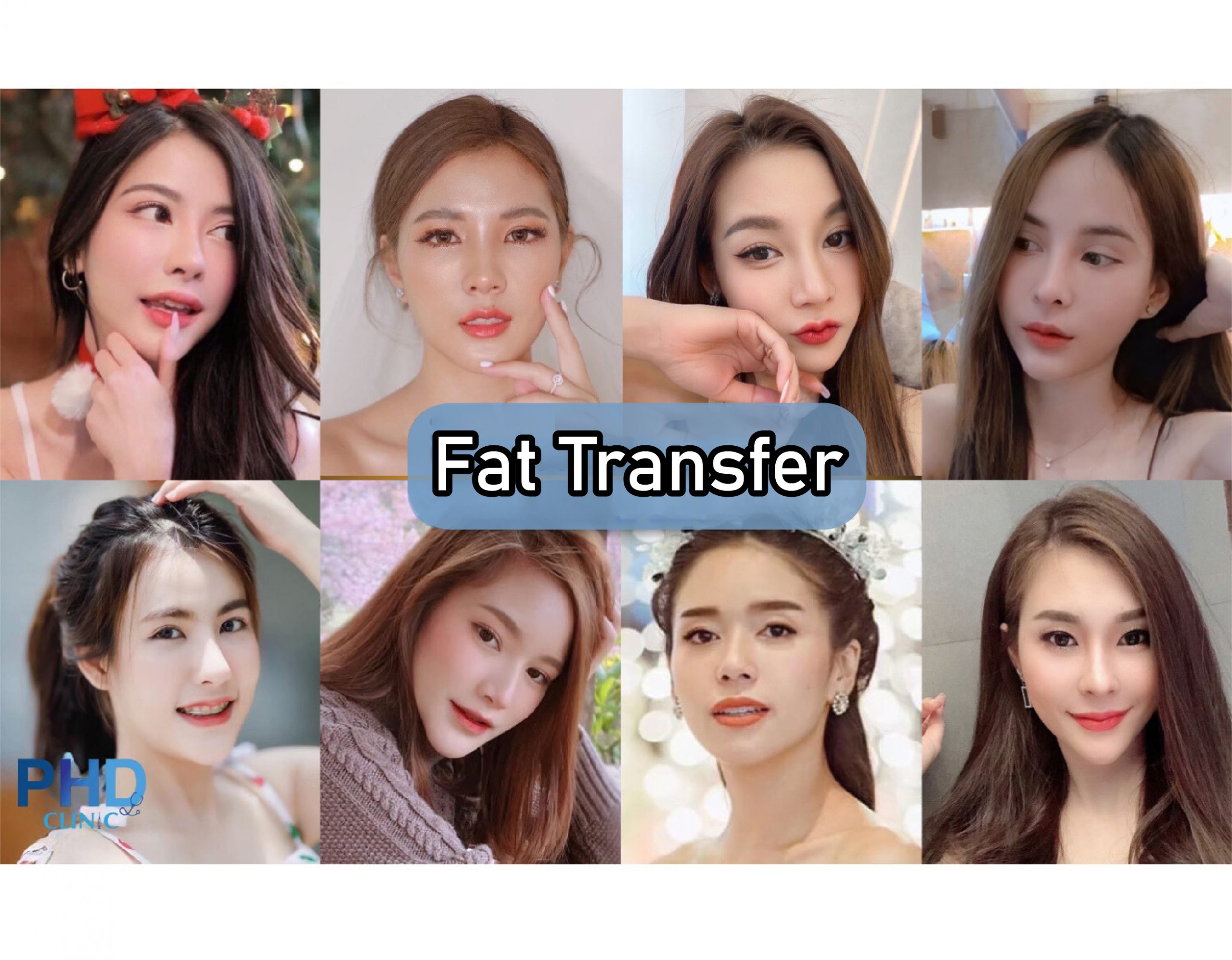 Fat Transfer