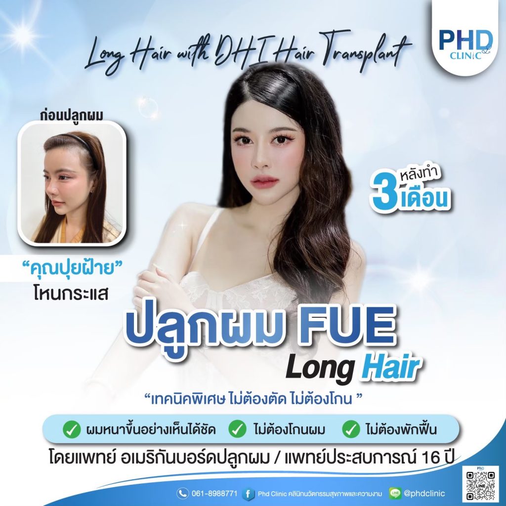 ปลูกผมภูเก็ต