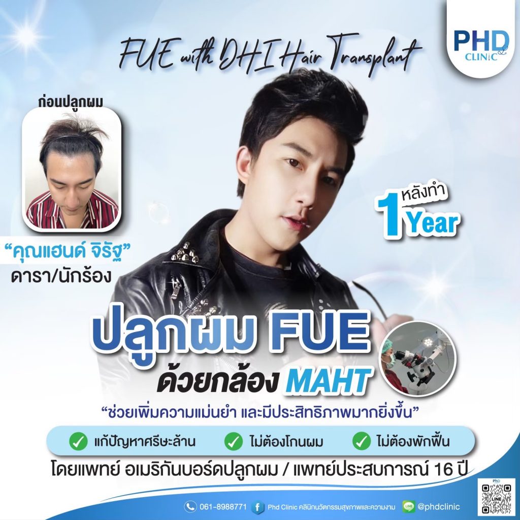 ปลูกผมภูเก็ต