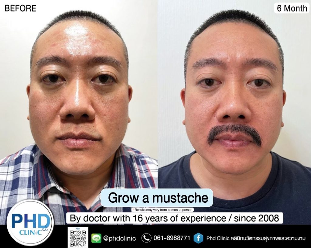 Grow mustache and beard phuket