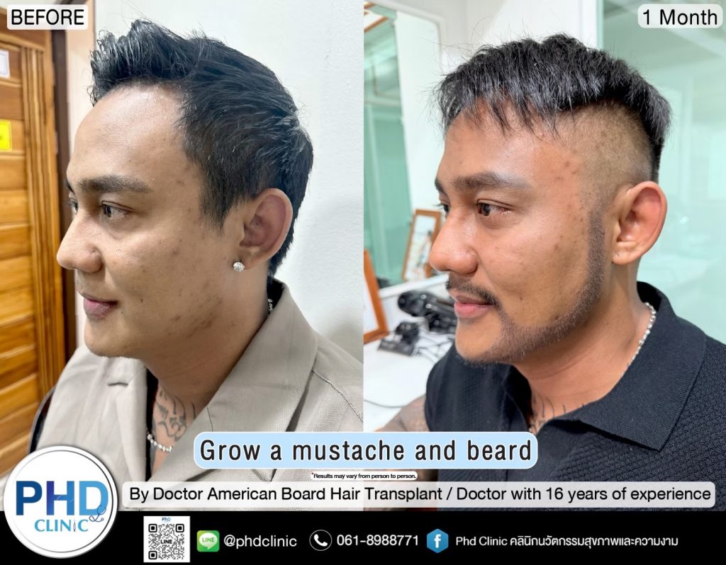 Grow mustache and beard phuket