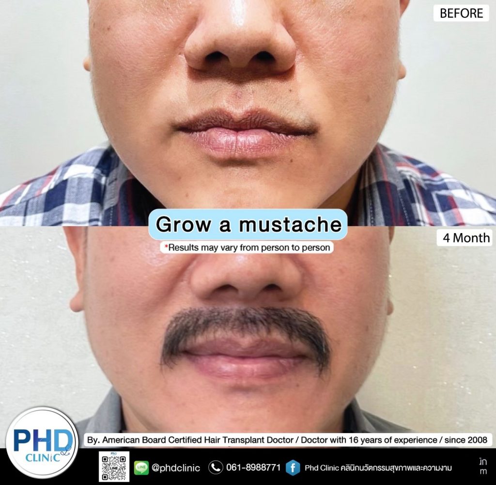 Grow mustache and beard phuket