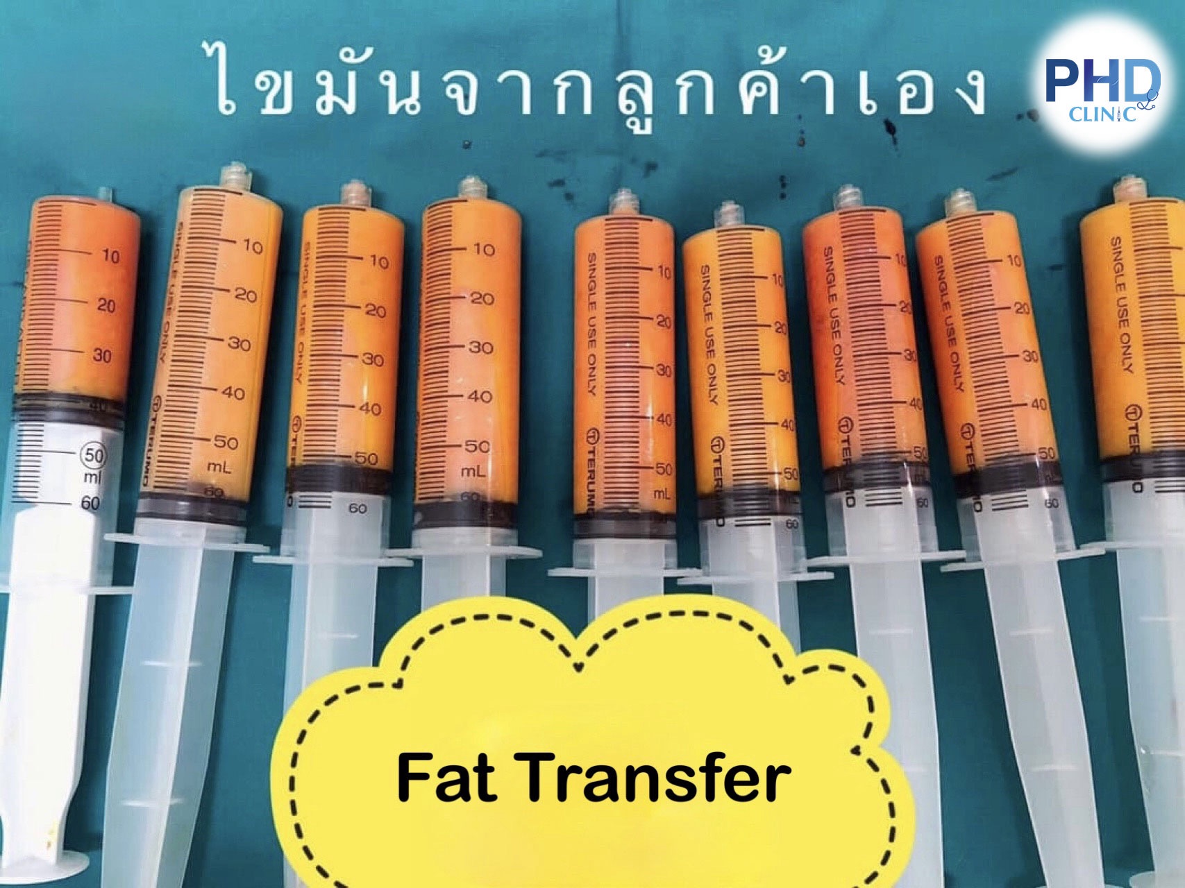 Fat Transfer