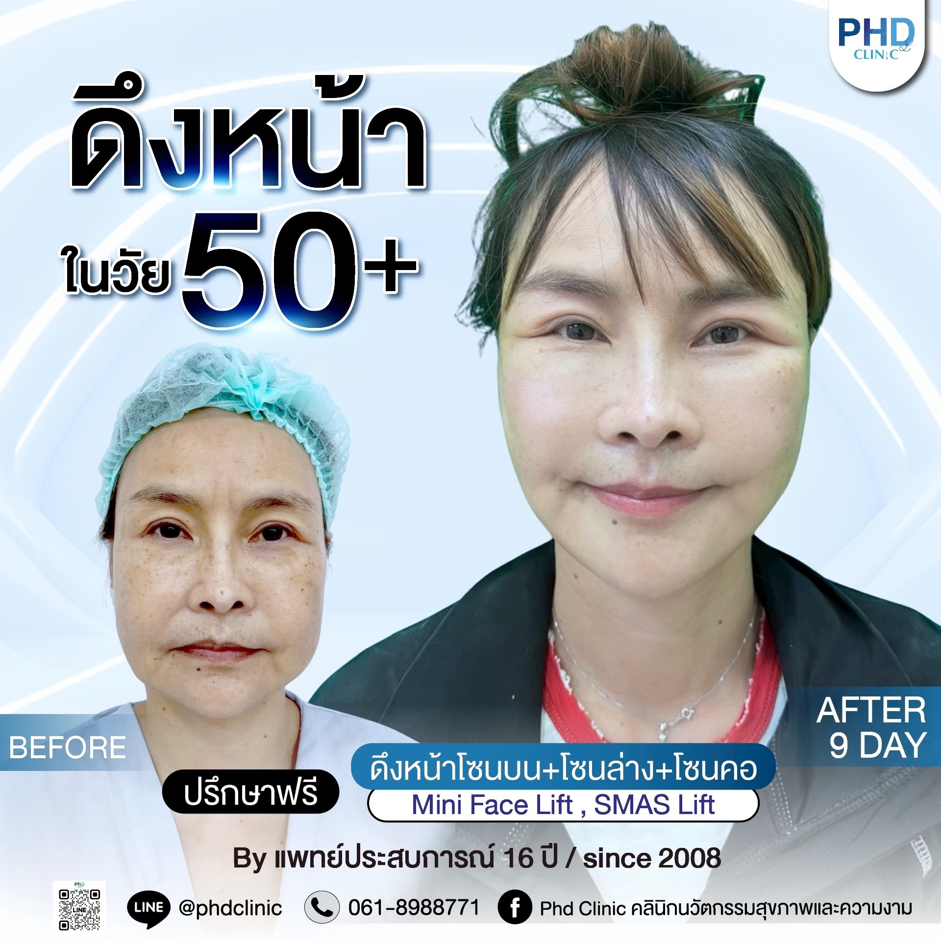 ดึงหน้า