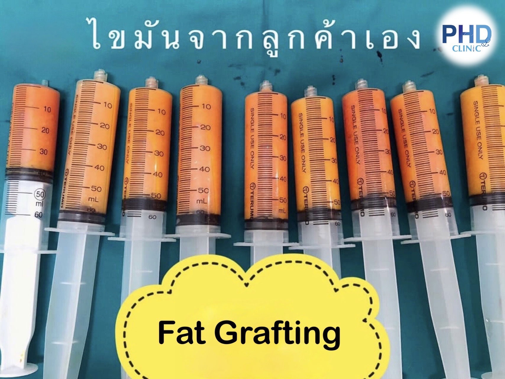 Fat Grafting Phuket