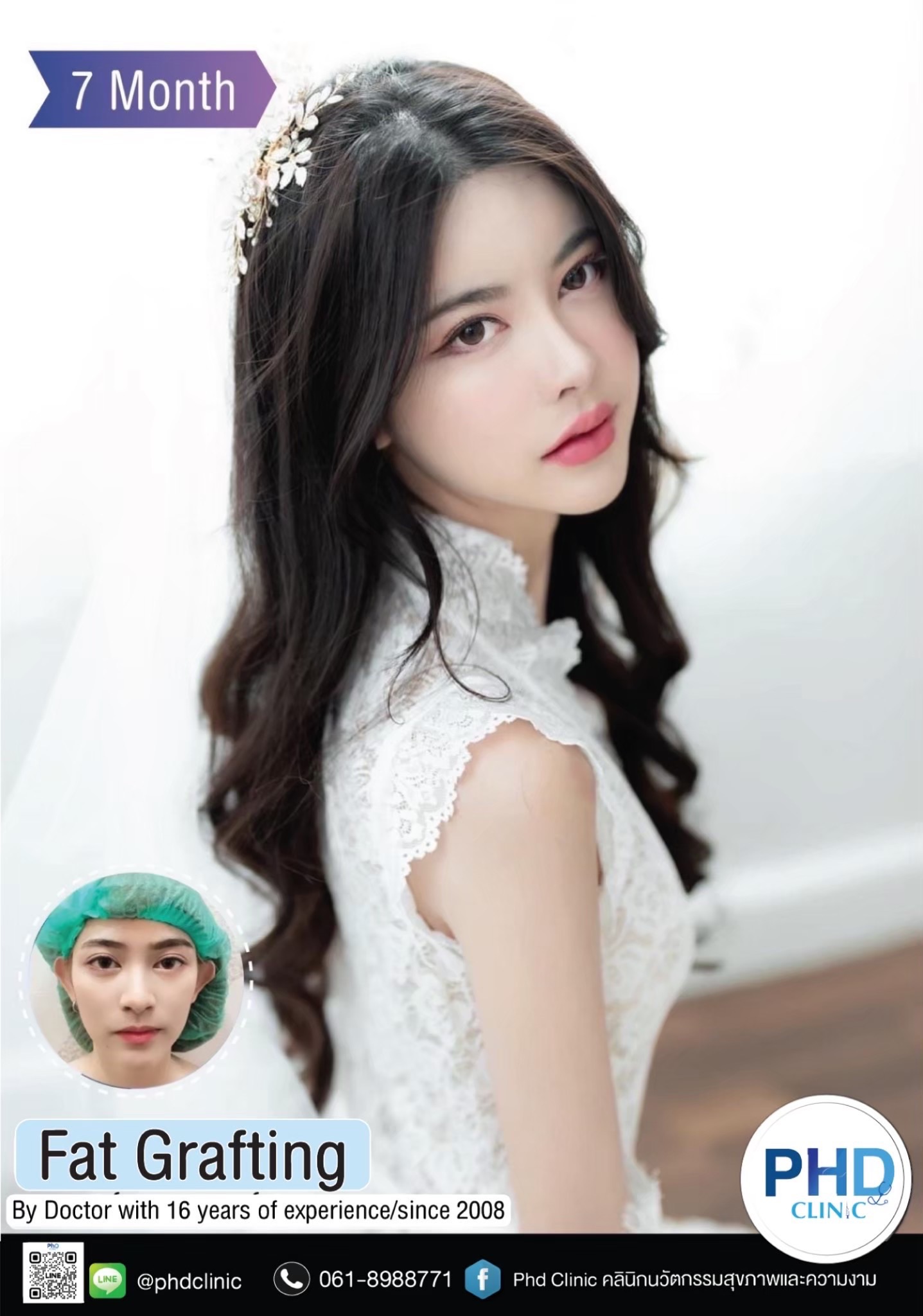 Fat Grafting Phuket