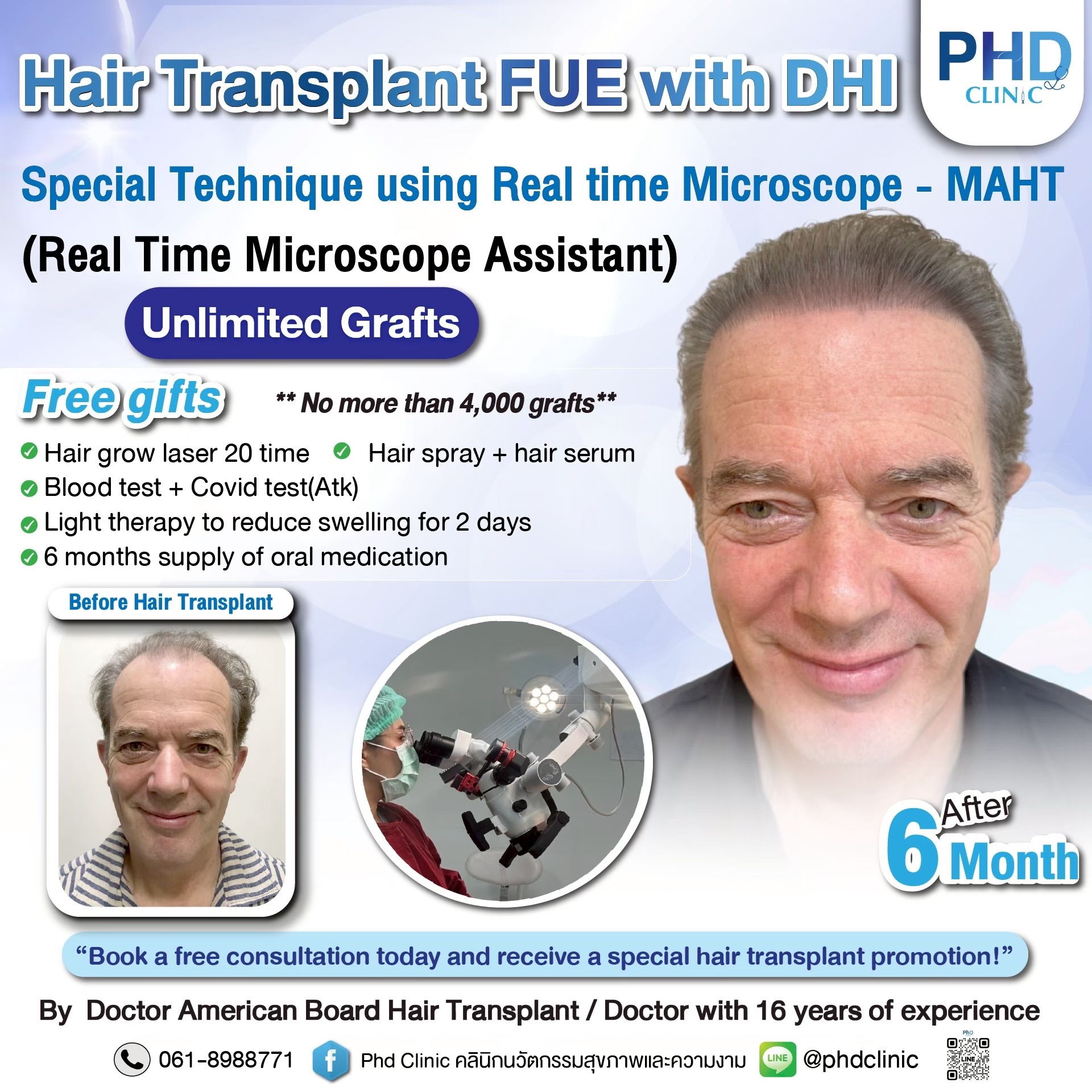 ABHRS hair transplant Thailand