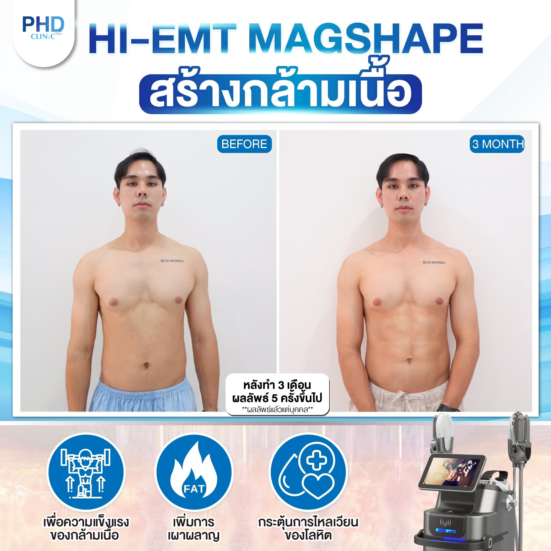 แผนกลดน้ำหนัก