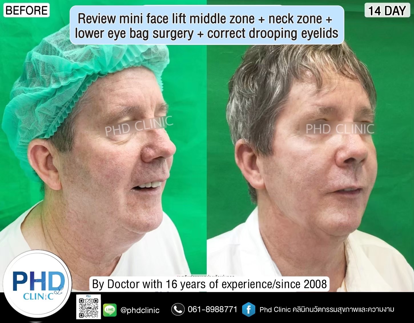 review