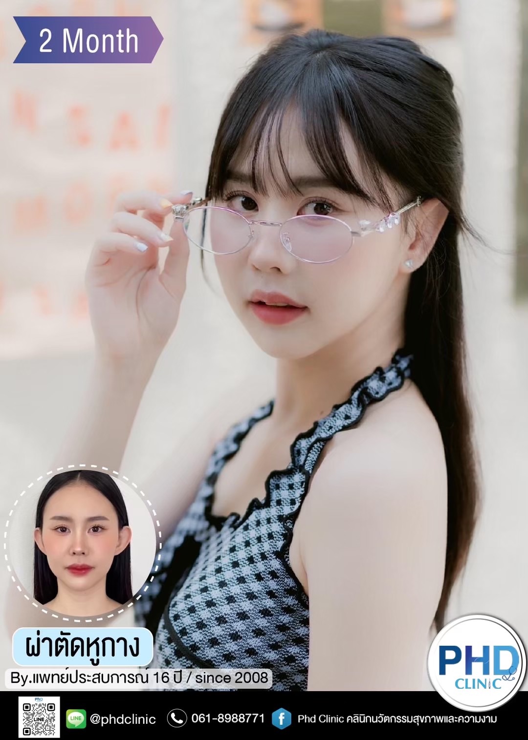 ผ่าตัดแก้หูกางพัทยา