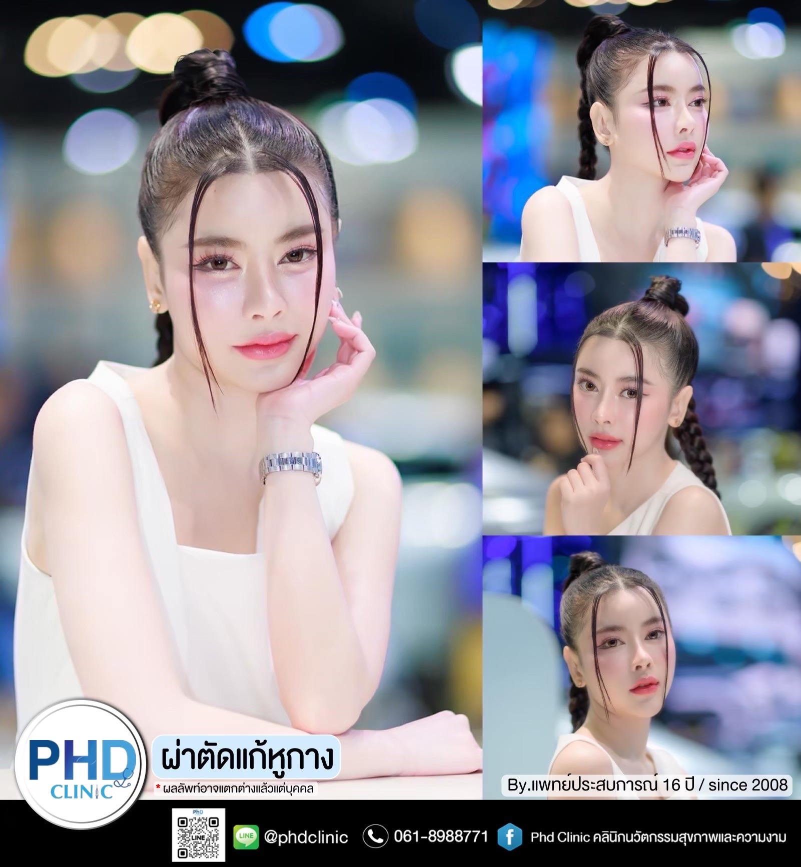 แก้หูกาง
