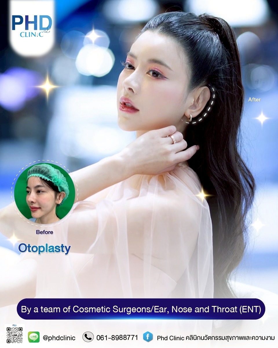 Where is the best Otoplasty in Phuket