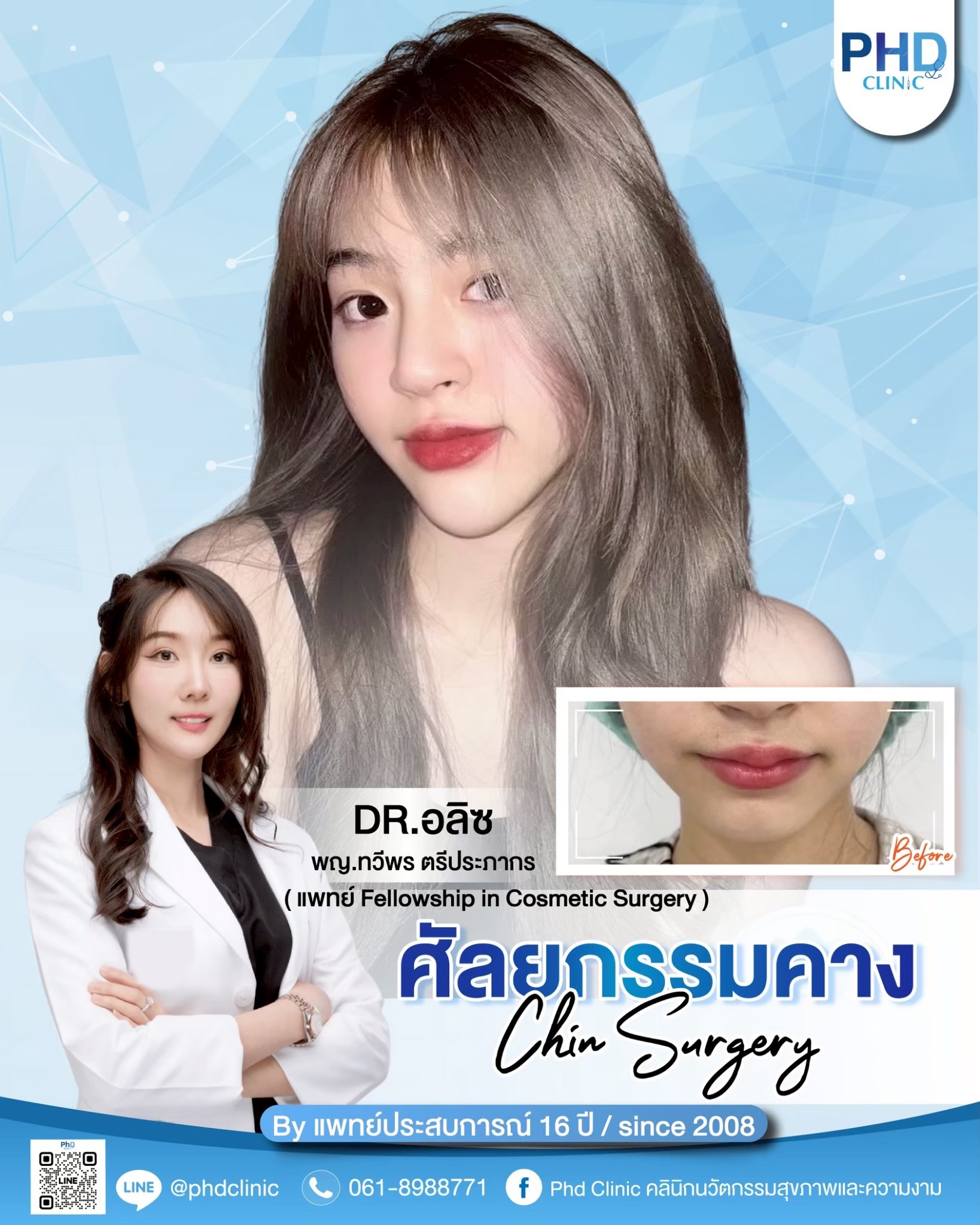 เสริมคาง
