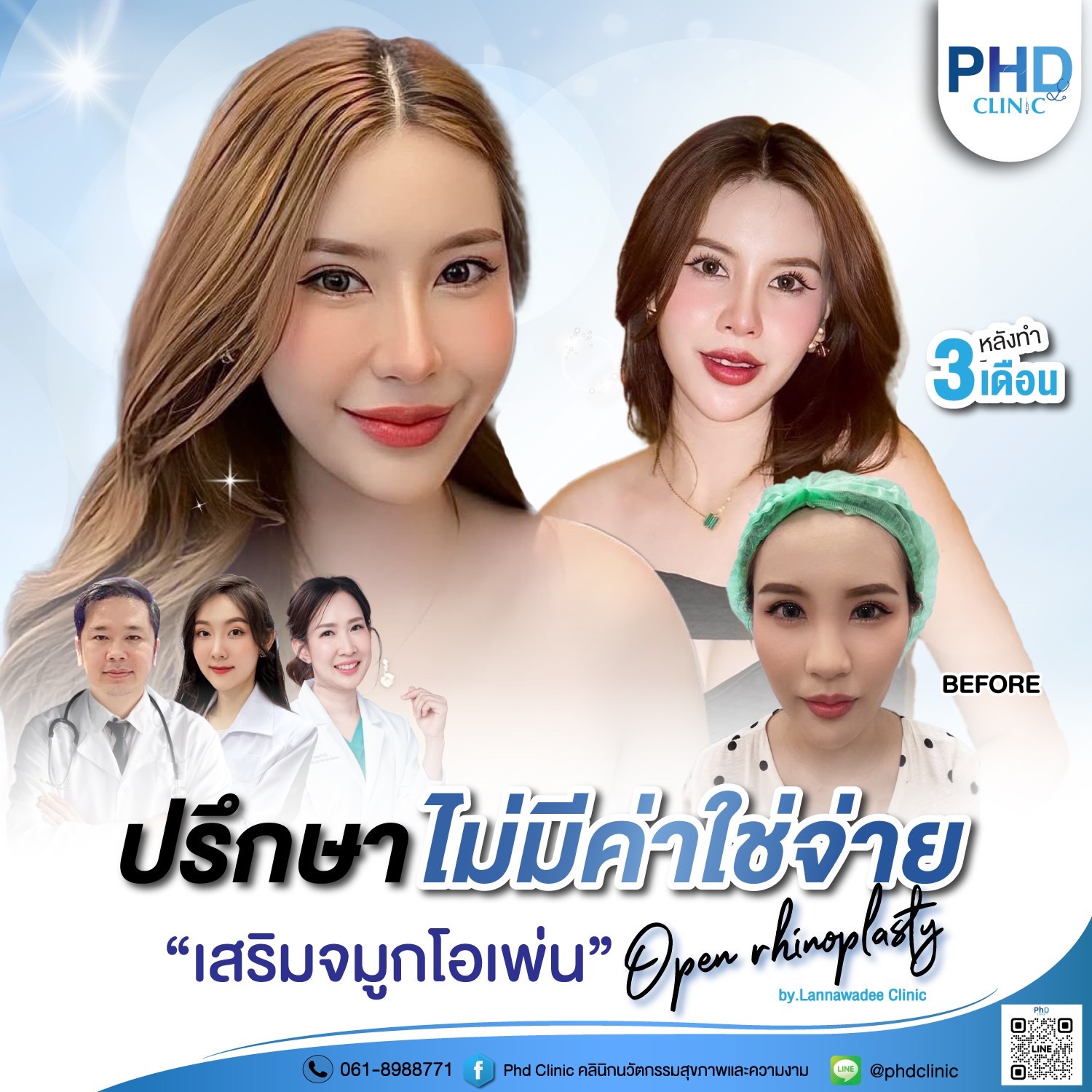 เสริมจมูก