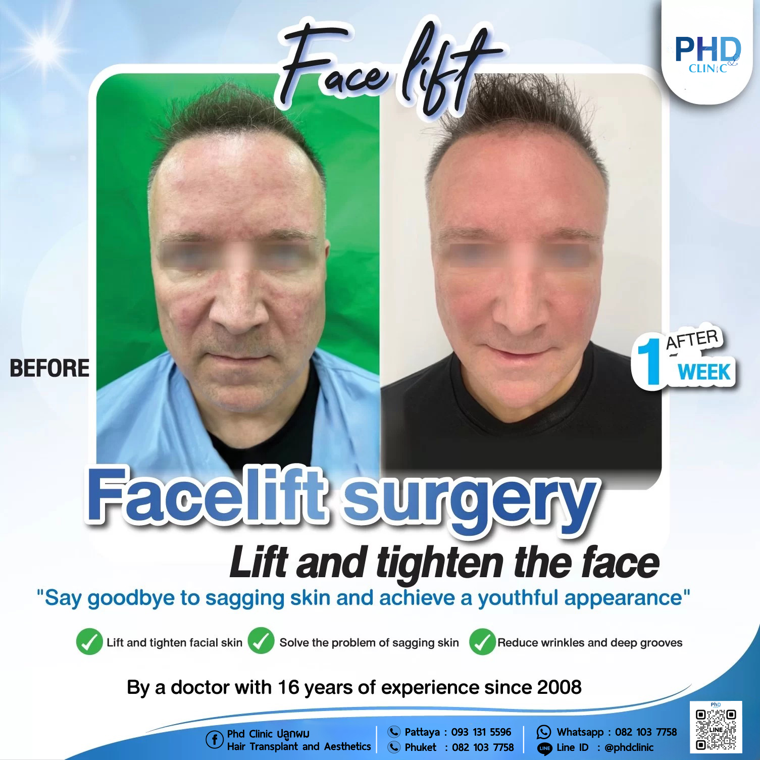 Facelift Bangkok