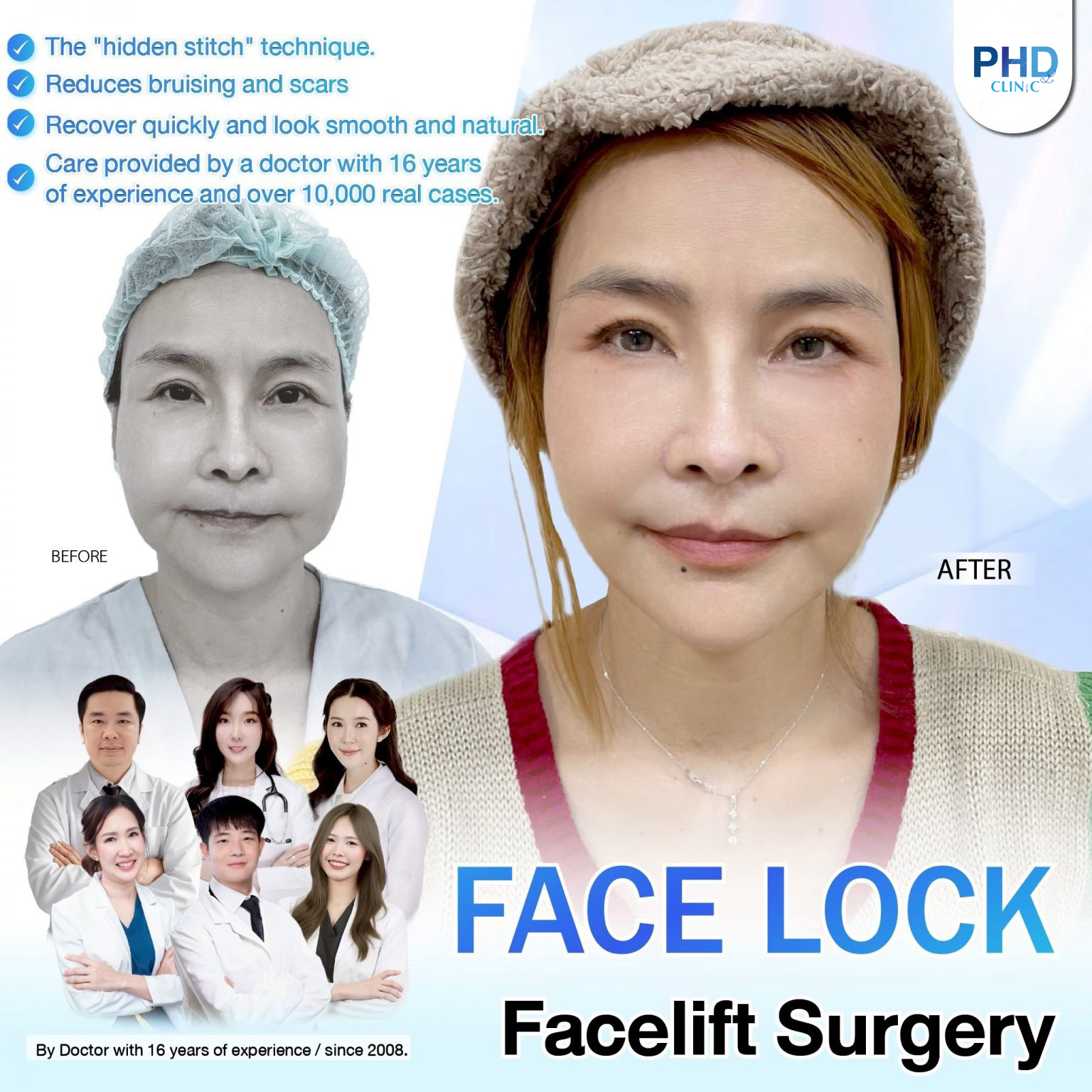 Facelift Bangkok