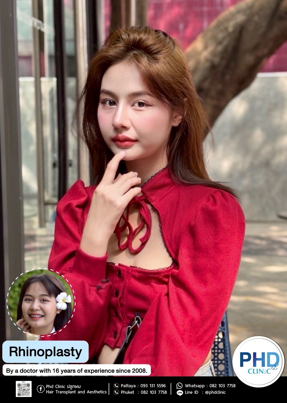 Rhinoplasty Bangkok