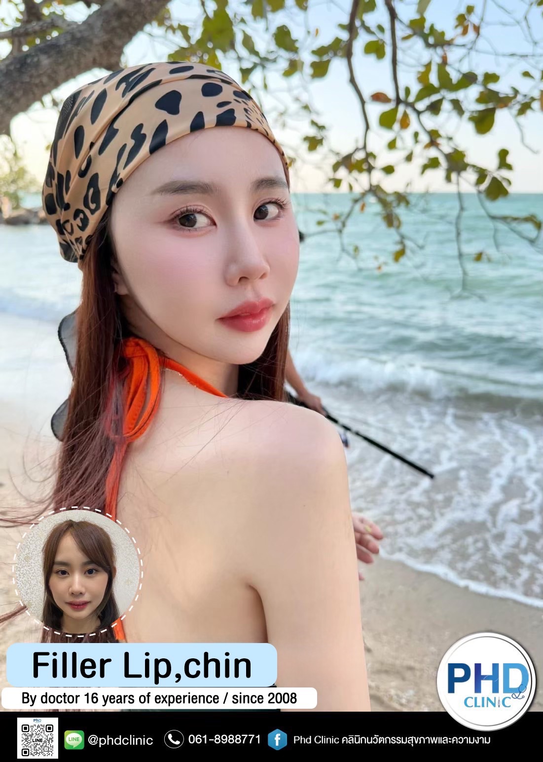 Filler phuket